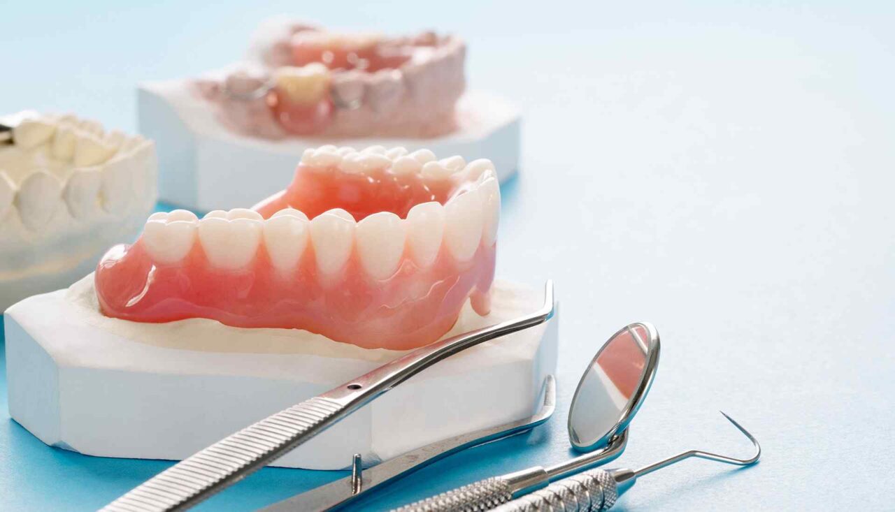 Dental bridge: Everything you need to knowThymianou Dental bridge: Everything you need to knowThymianou